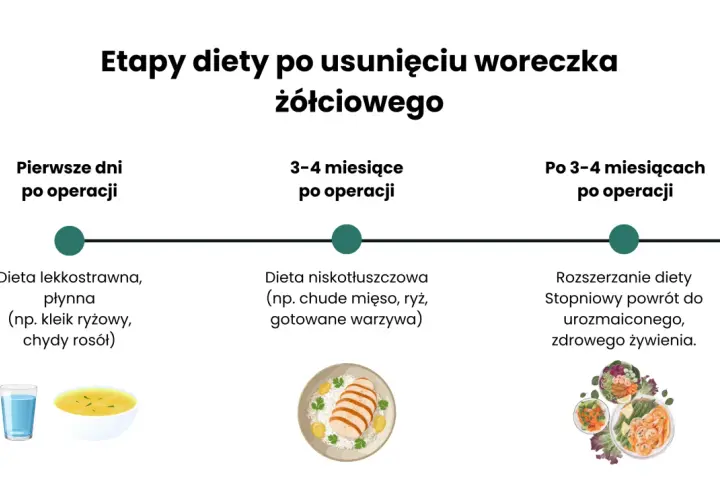 Dieta po usunięciu woreczka żółciowego: płynna, niskotłuszczowa, a potem powrót do zdrowego żywienia.