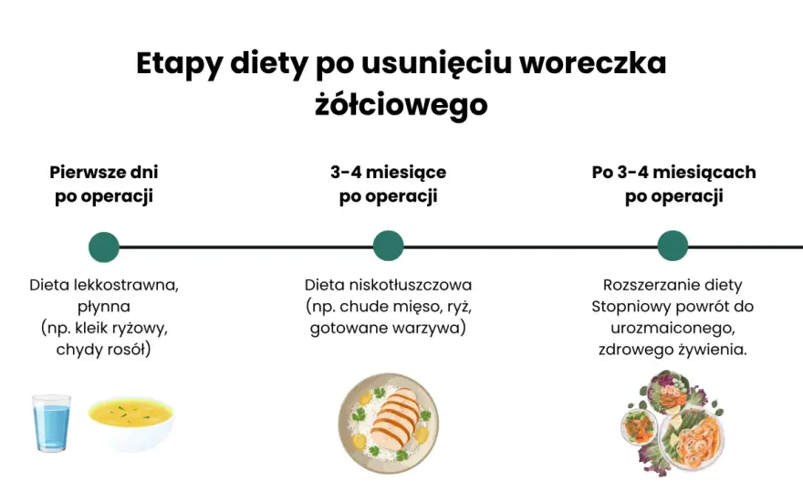 Kawa po usunięciu pęcherzyka żółciowego - kiedy wrócić?